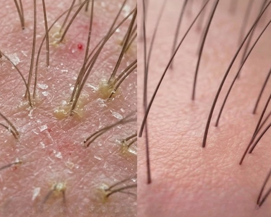 Scalp Scrubbing: Why It's the Step You're Skipping